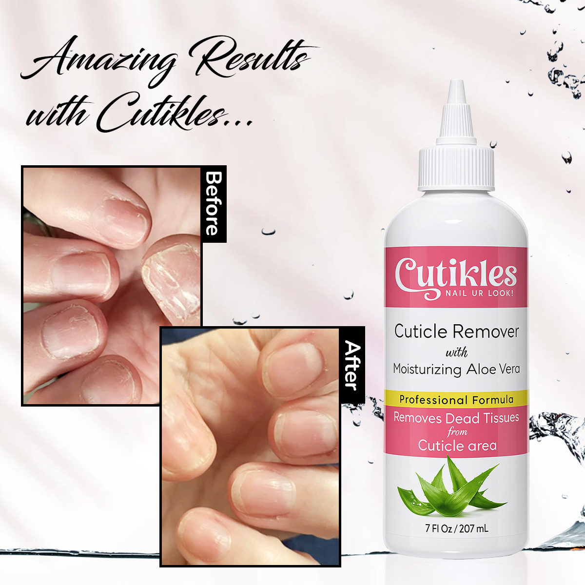 Cutikles Cuticle Remover – Instantly Removes Dead & Overgrown Cuticles | Professional-Grade Formula - 30ml/200ml - Image 3