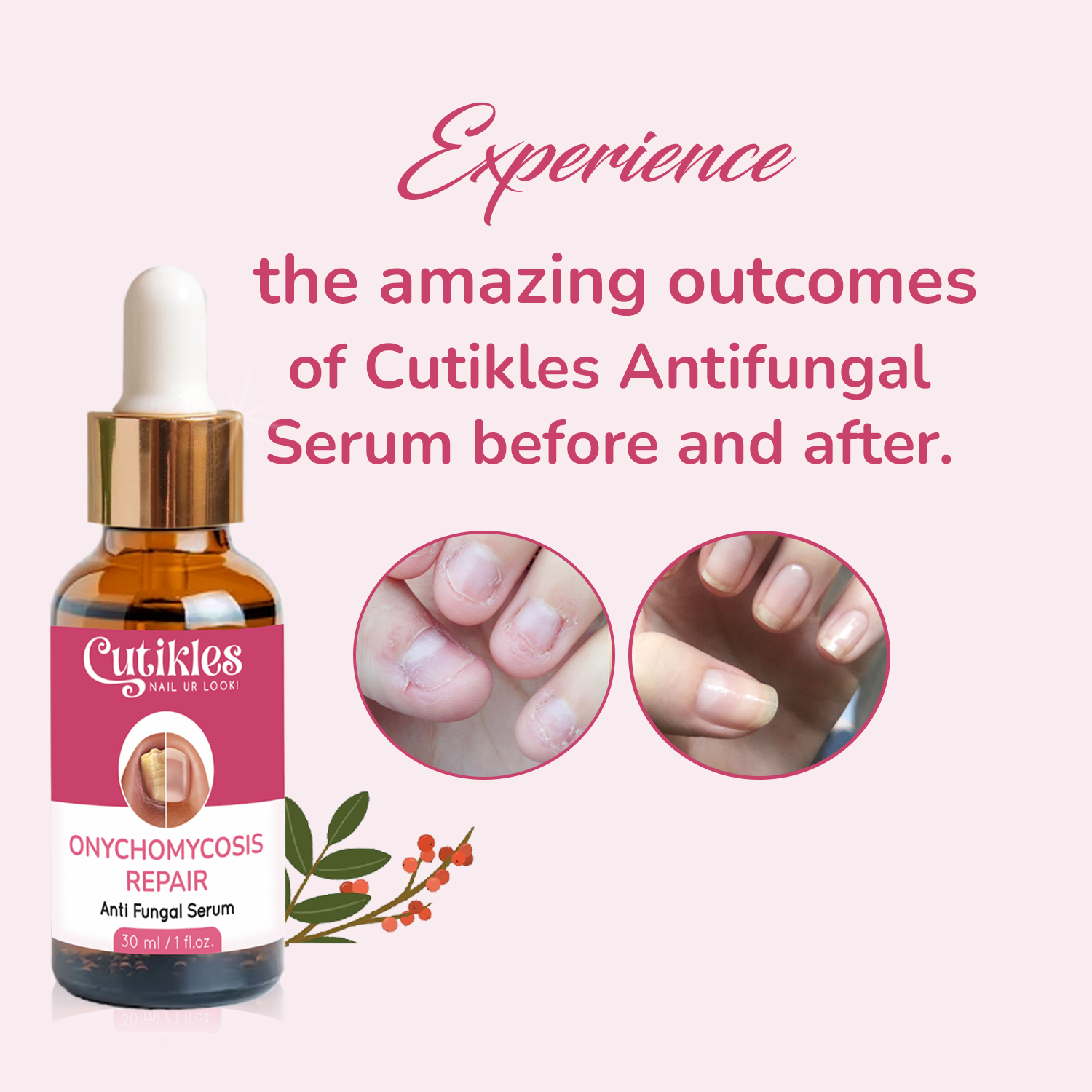 Cutikles Anti-Fungal Nail Serum – Growth, Repair & Shine (30ml) - Image 5
