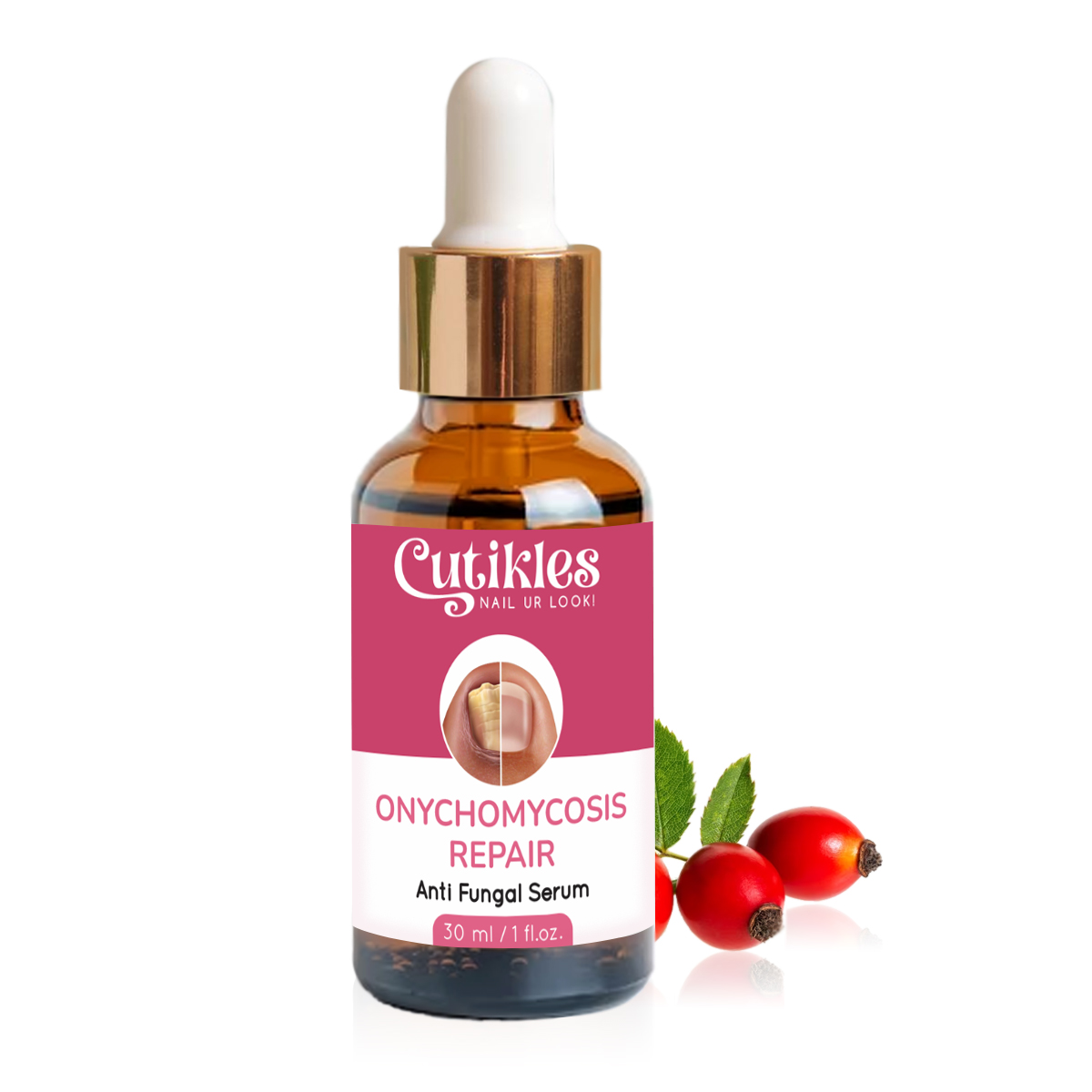 Onychomycosis Repair